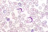 Trypanosomes dans le sang humain - Trypanosoma gambiense x200